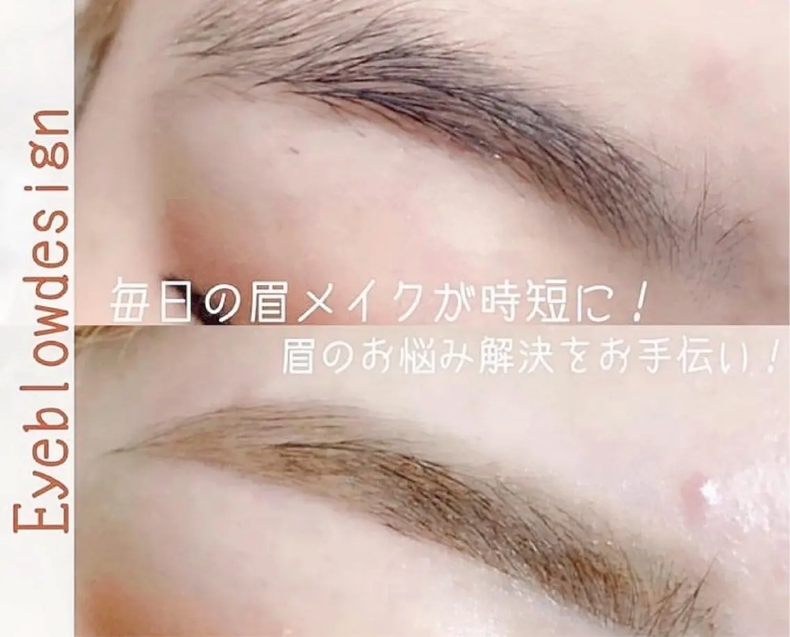 ワックス脱毛(１回)間引きは行いません。前後1週間角質ケアNG/前後2週間ピーリングNGの写真