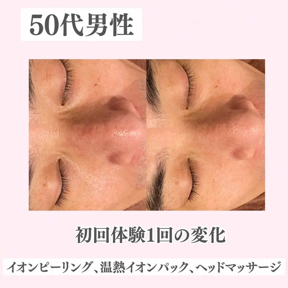 エステ リラク ニキビ・肌質改善専門 ♡人生が変わるサロンのエステ・リラクイメージ