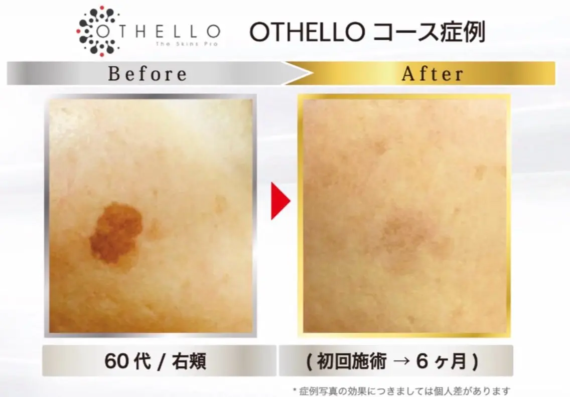 エステ VANISH たやがきの眉毛・アイブロウイメージ