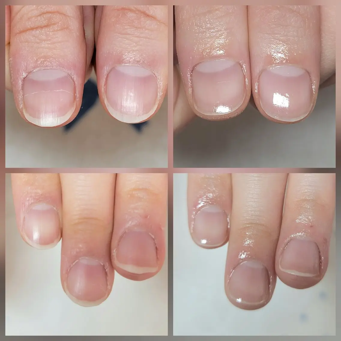 ネイル ネイル&巻き爪サロン AKnailのネイルデザイン