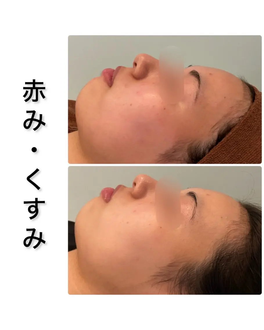 エステ ハーブピーリング専門 BIOPLUS＋川崎のエステ・リラクイメージ