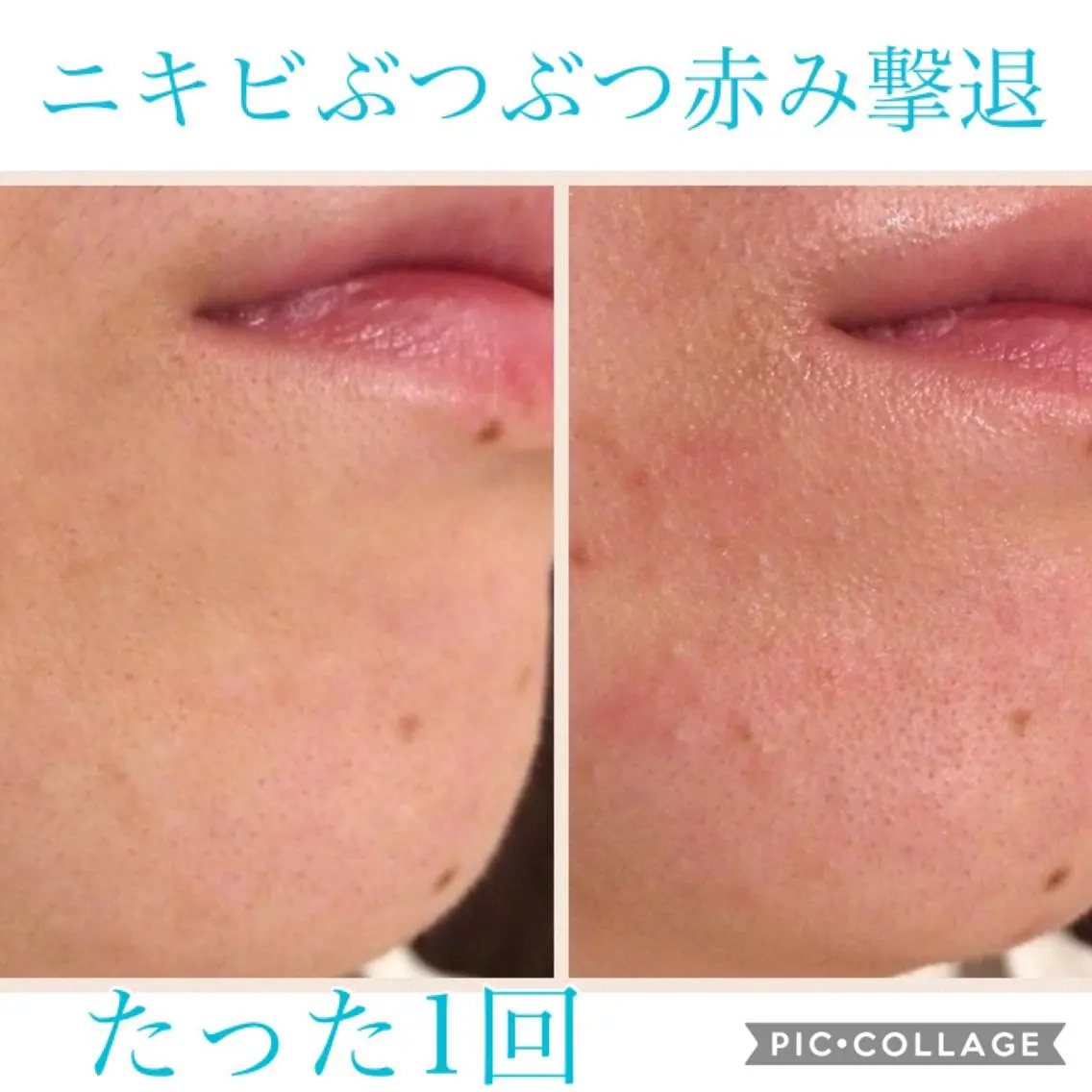 ロング カラー パーマ ヘアアレンジ キッズ ネイル マツエク・マツパ EnsorClair 代表　野口真央のエステ・リラクイメージ