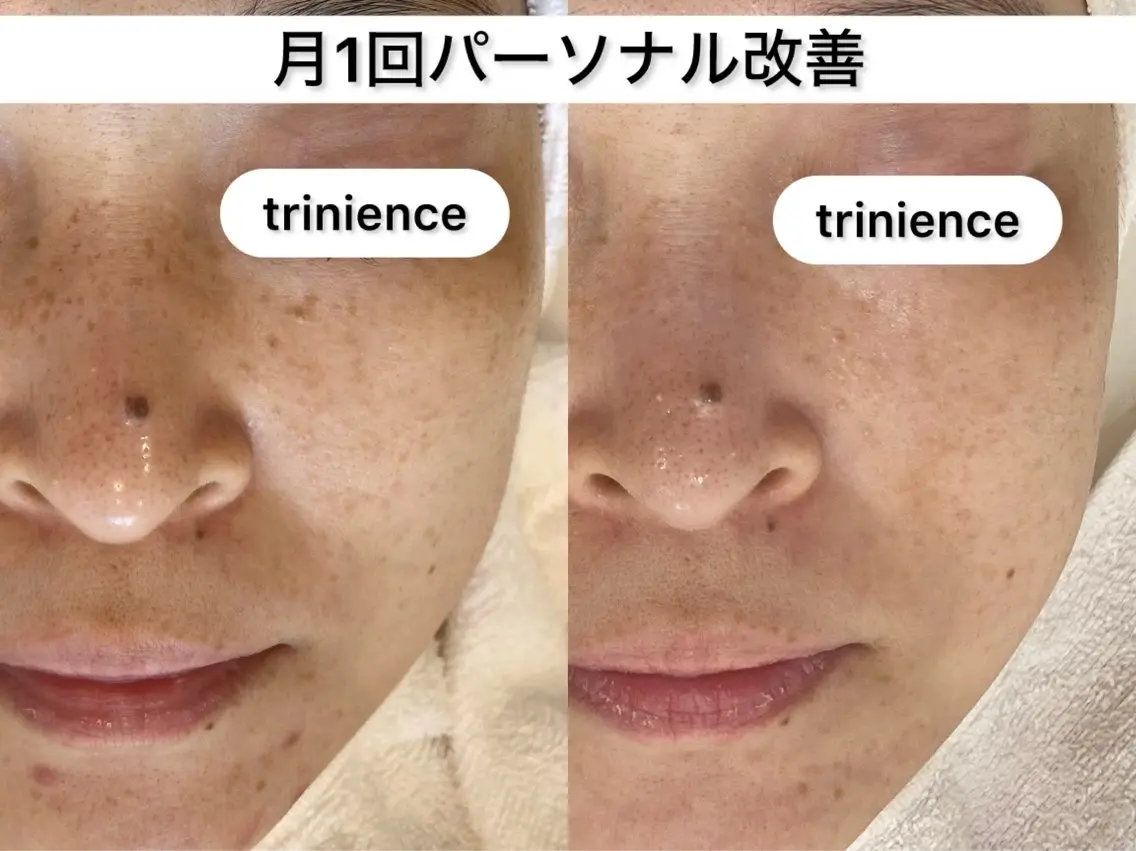 TRINIENCE 南流山店のエステ・リラクイメージ