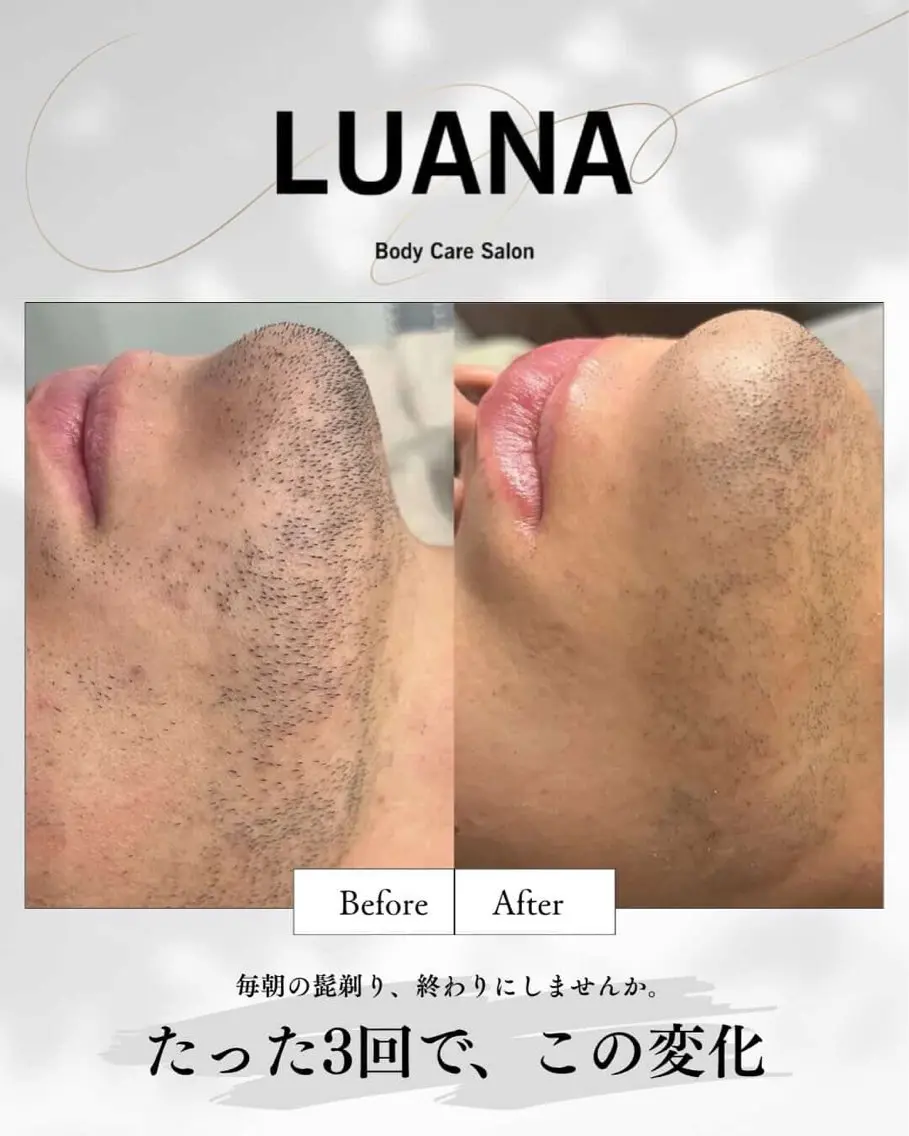 メンズ 脱毛 LUANA/小顔整体 men's脱毛のエステ・リラクイメージ