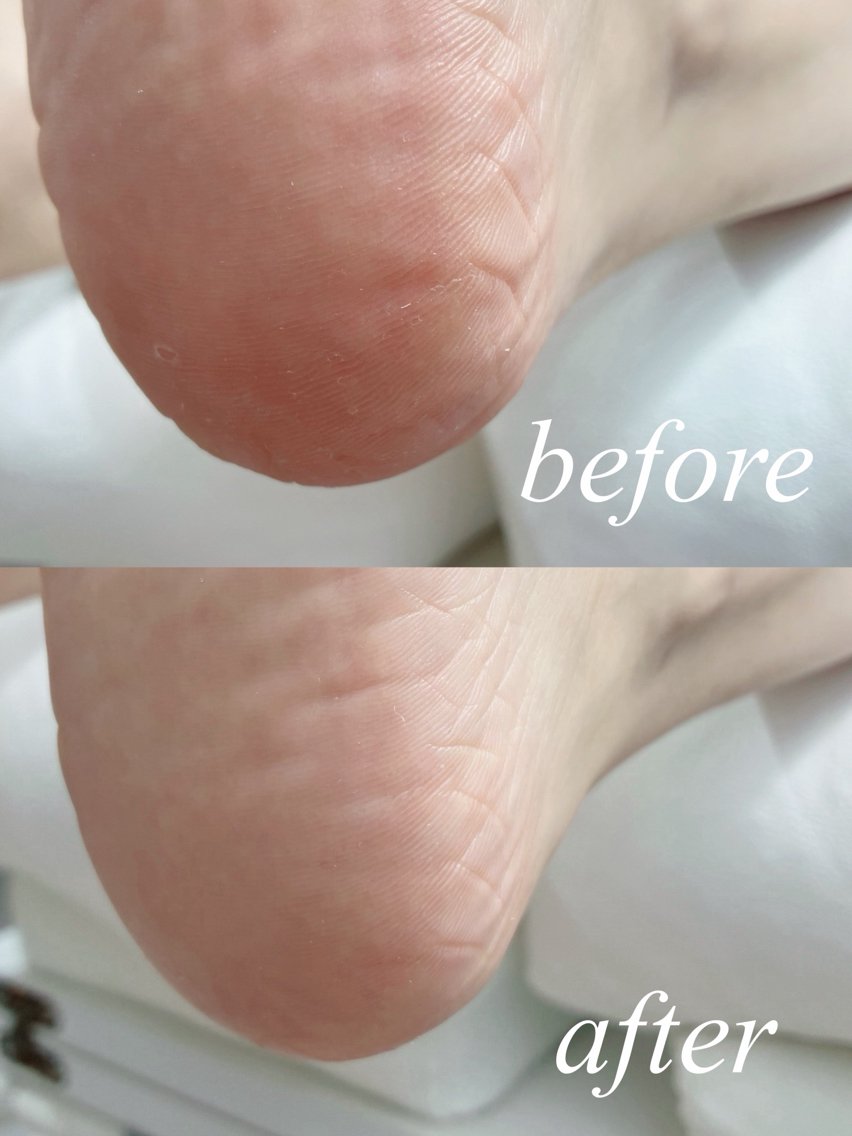 ネイル フットネイル その他(ネイル) nailsalon anrireのネイルデザイン