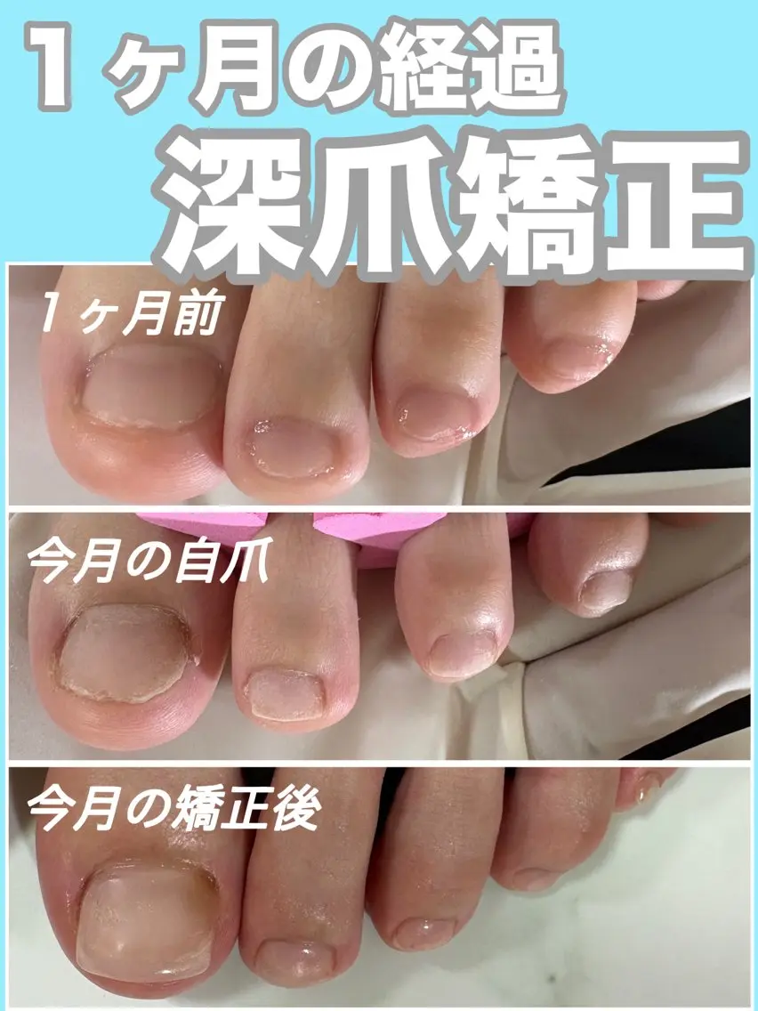 ネイル クリアネイル 長さ出し ジェルネイル フットネイル nail salon petillantのネイルデザイン