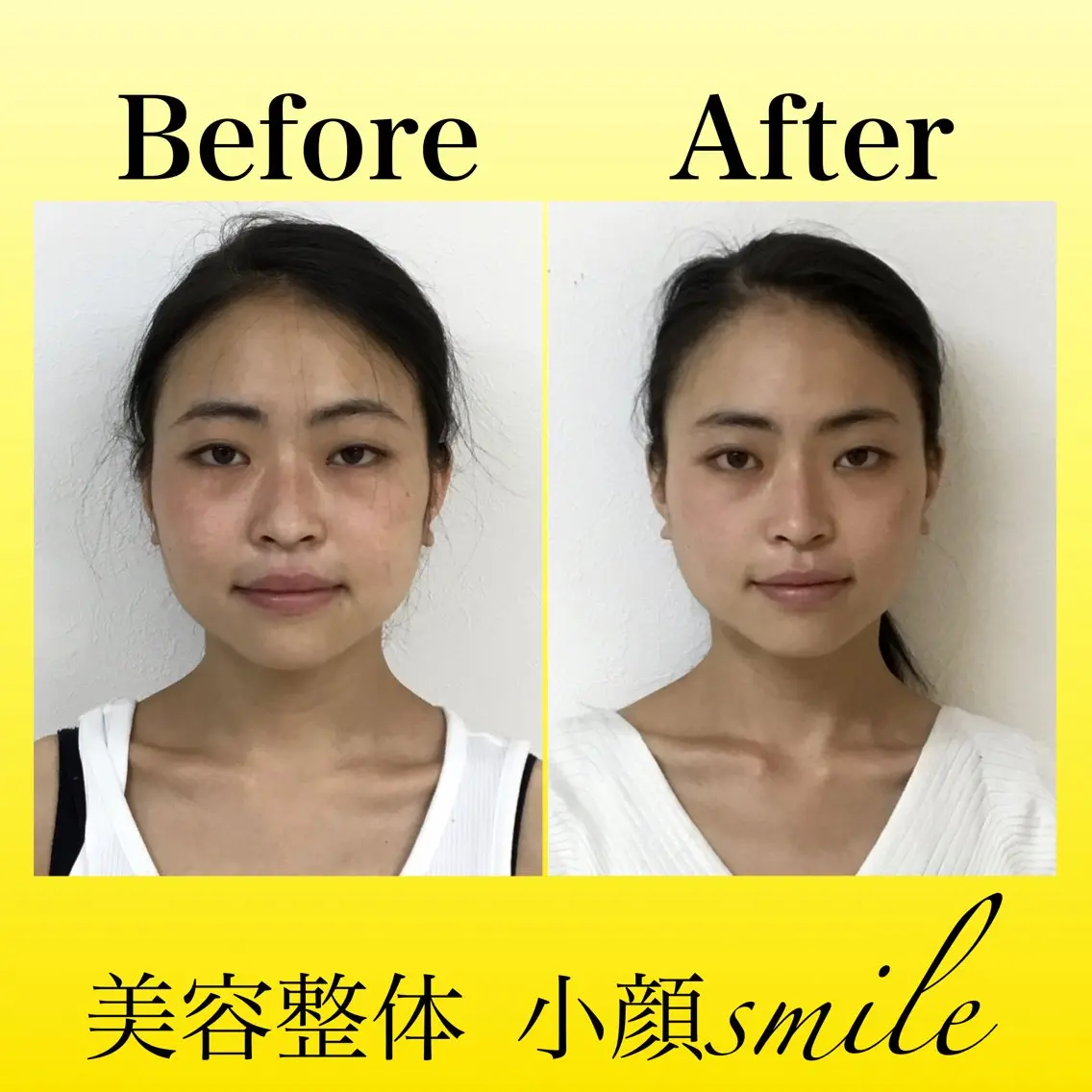 エステ リラク 【小顔矯正専門】 小顔smileのエステ・リラクイメージ
