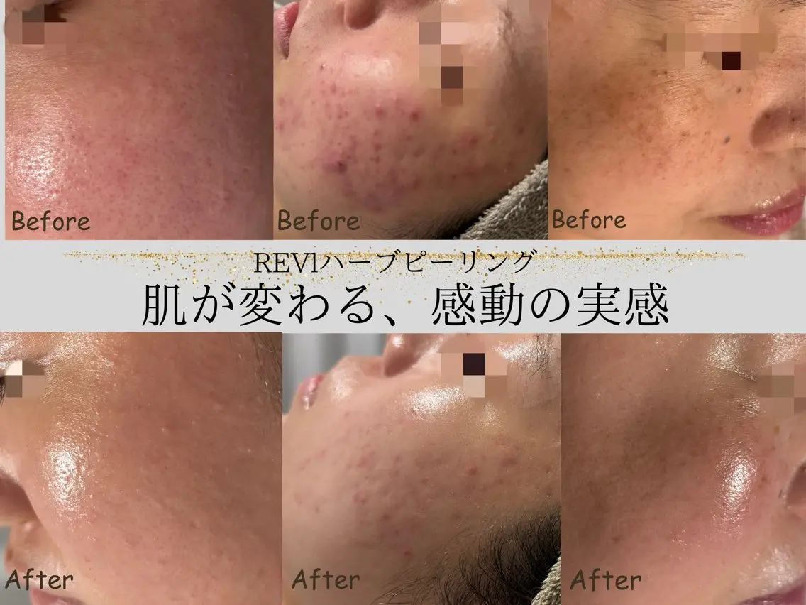 エステ リラク lumi riseのエステ・リラクイメージ