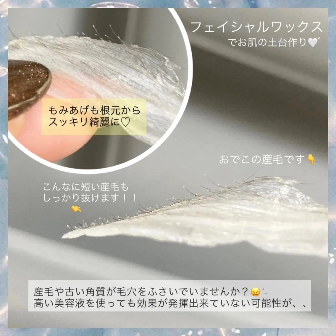 脱毛 EyeLash Lirio リリオのエステ・リラクイメージ