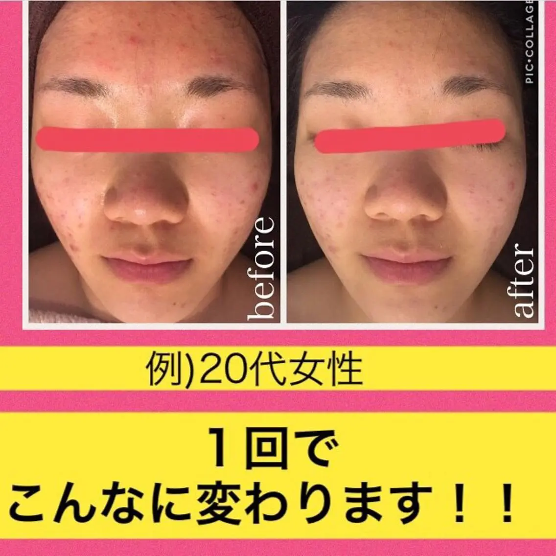 ミディアム カラー パーマ ヘアアレンジ メンズ キッズ ネイル マツエク・マツパ ニキビ・肌質改善専門 ♡人生が変わるサロンのエステ・リラクイメージ