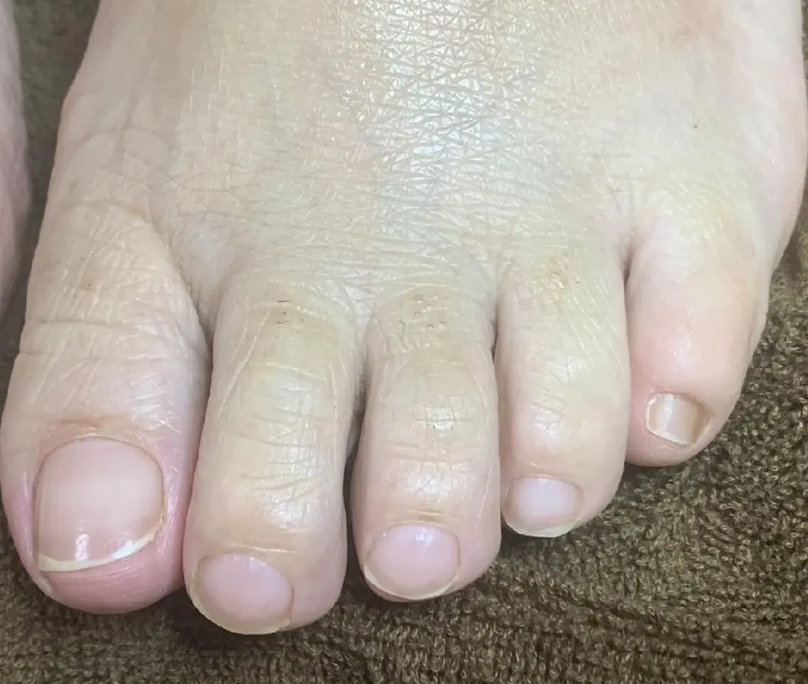 ネイル carenail　 tsugumiのその他イメージ