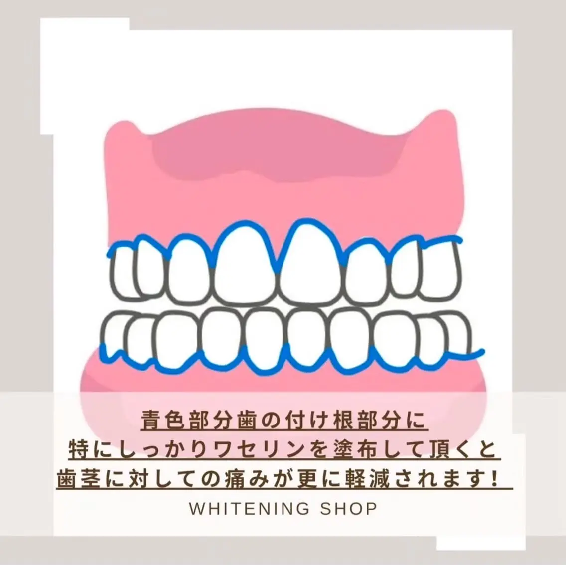 ホワイトニング ショップ伊丹店のその他イメージ