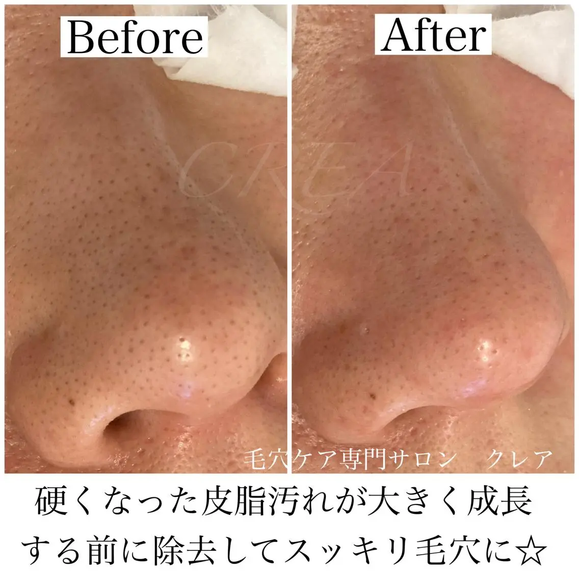CREA【クレア】 川中のマツエク・マツパデザイン