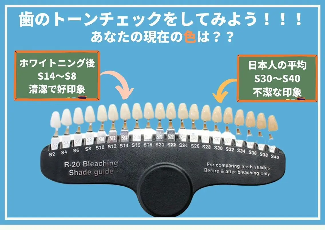 歯のホワイトニング HARU南浦和のその他イメージ