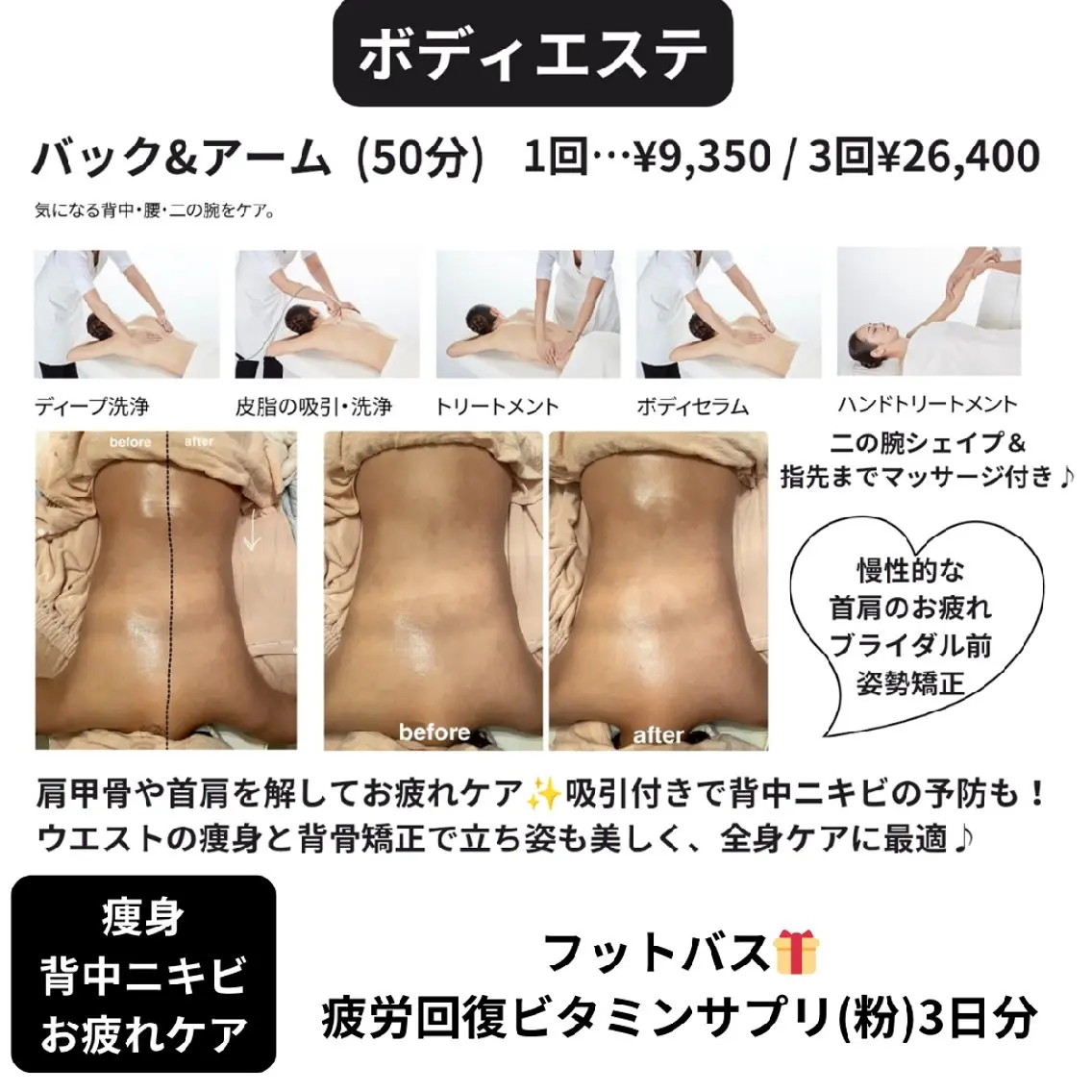 POLAボディエステ!慢性的な肩甲骨まわりのお疲れや痩身に!の写真