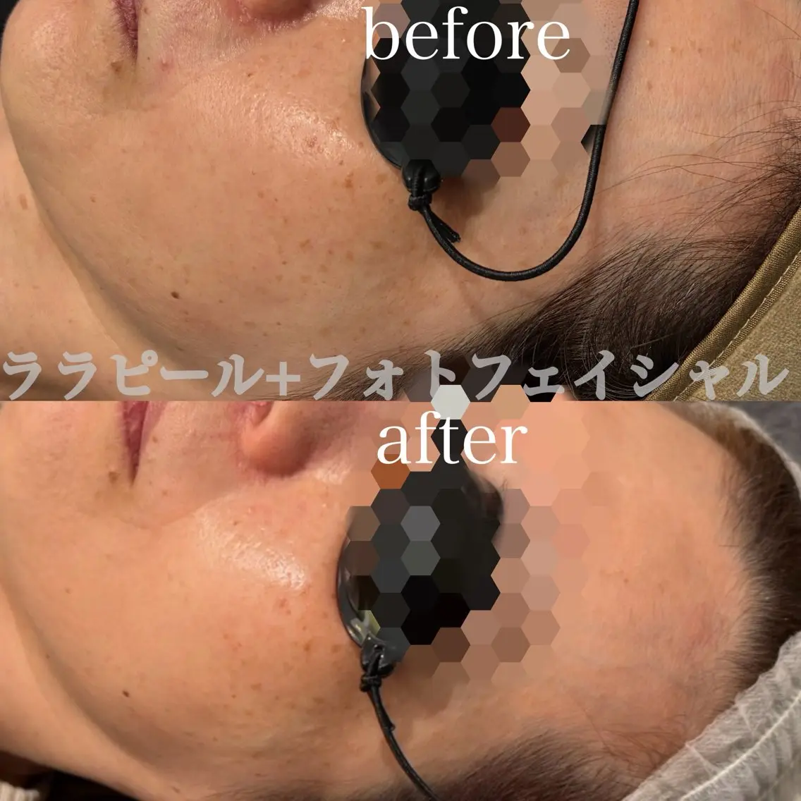 エステ Esthetic ReTweetのエステ・リラクイメージ