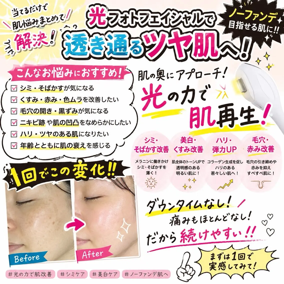 【初回】透明感あふれるシミケア可能◇光フェイシャルの写真