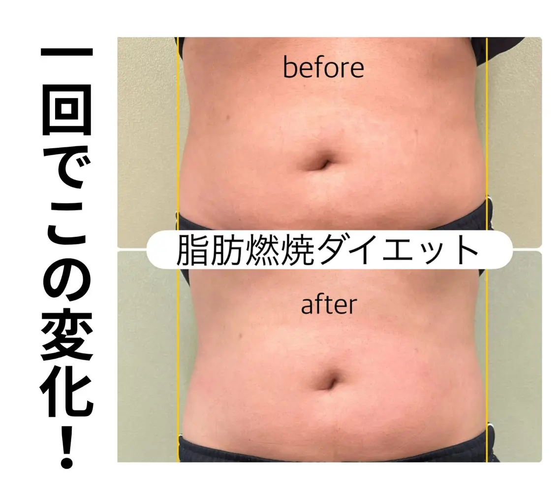 ほねつぎ一休さん 宇品店のエステ・リラクイメージ
