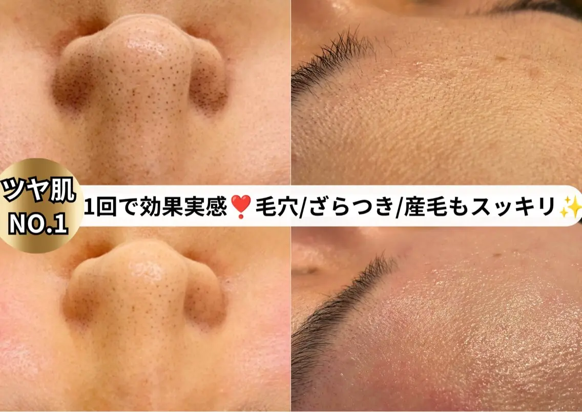 エステ 心斎橋/美肌管理専門 muroのエステ・リラクイメージ