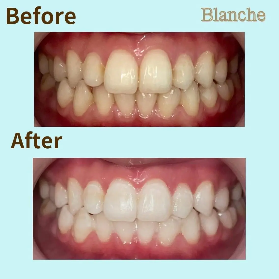 その他 Blanche 心斎橋のその他イメージ
