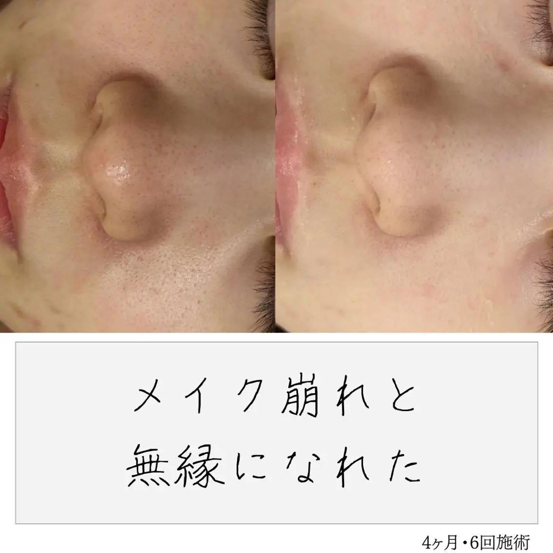 ニキビ経験者が施術 する専門サロン🌻のエステ・リラクイメージ