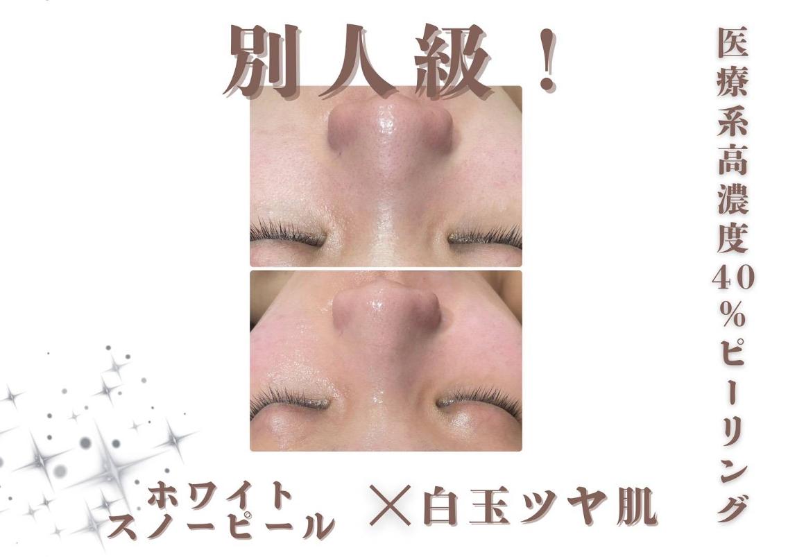 エステ 🫧美肌サロン🫧 レイビスひかる🧡のエステ・リラクイメージ