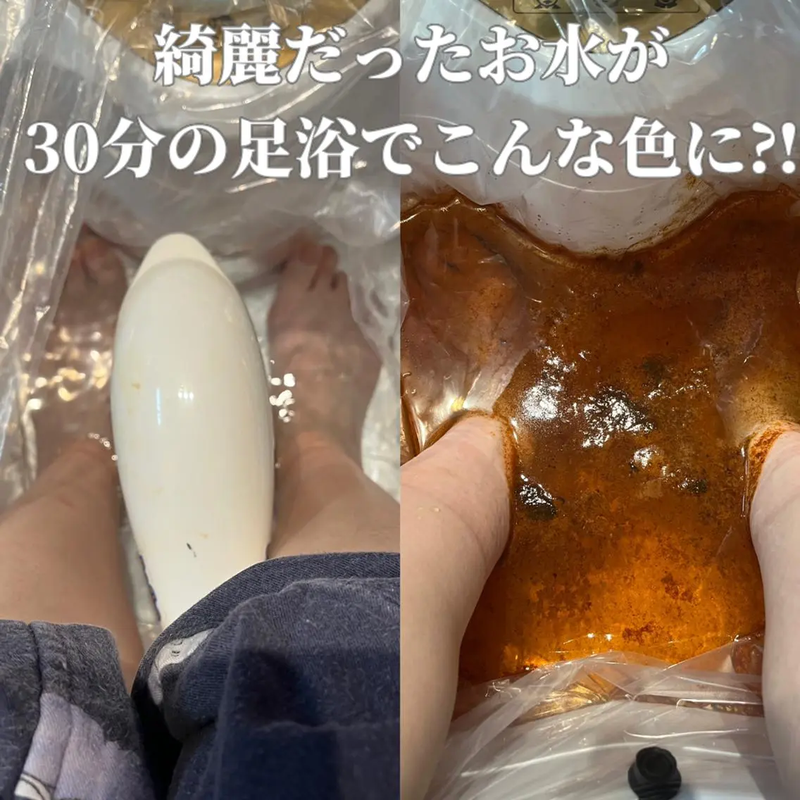 【お試し30分♪】高濃度水素足浴(ゴッドクリーナー)30分 4500円の写真