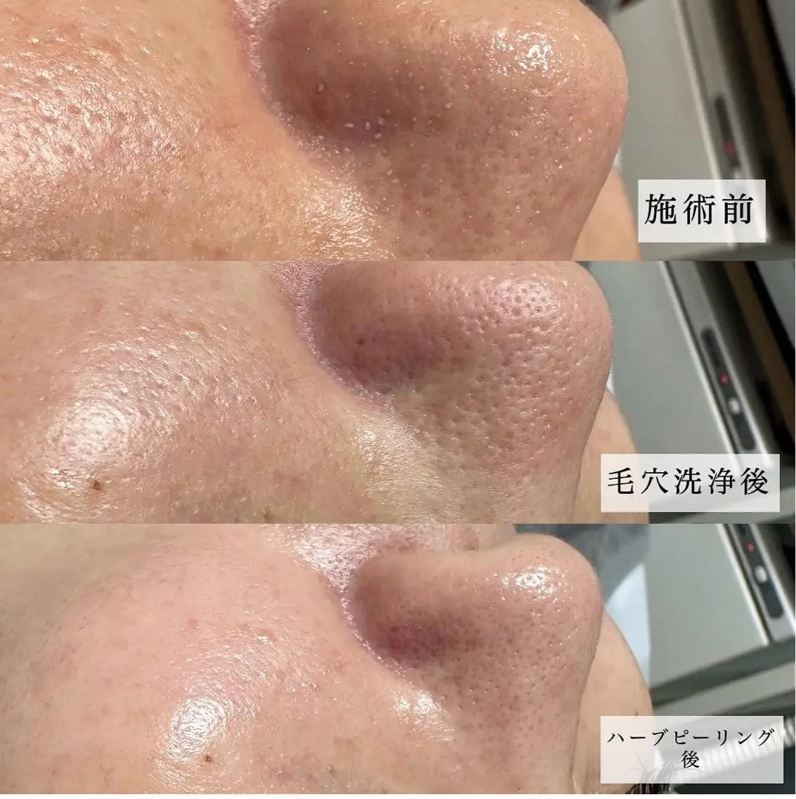 エステ 木村 綾子のエステ・リラクイメージ