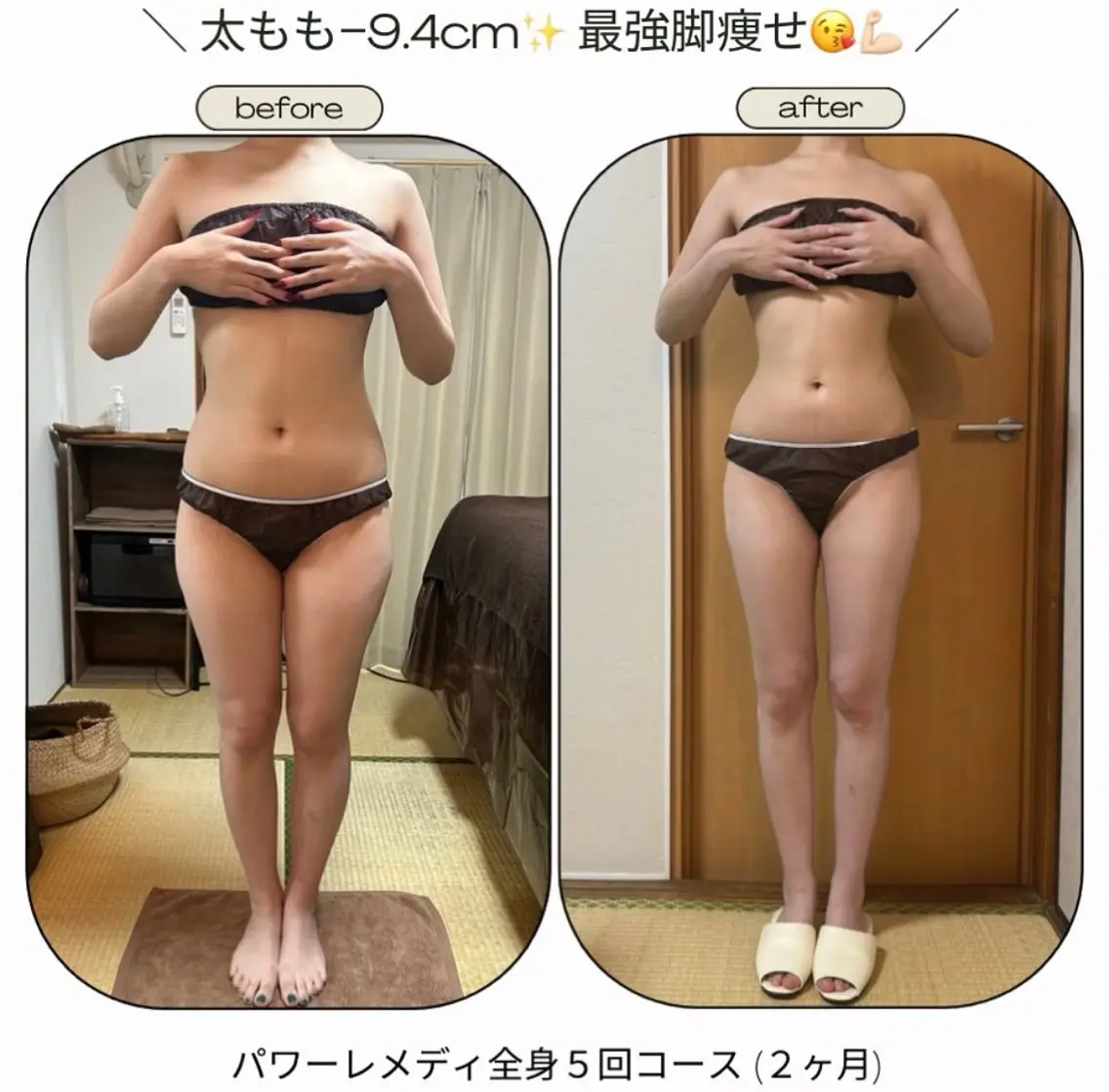 エステ リラク 《本気痩せ×疲労改善 》  BILOOPのエステ・リラクイメージ