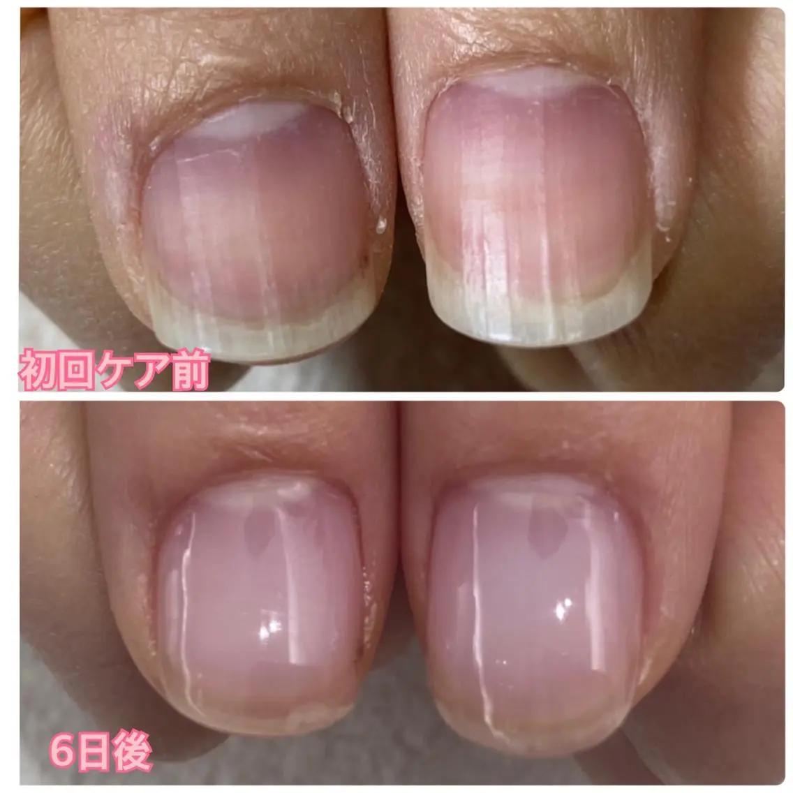 ネイル ハンドネイル ハンドケア 大人可愛い高技術ネイ ル♡美爪A nailのネイルデザイン