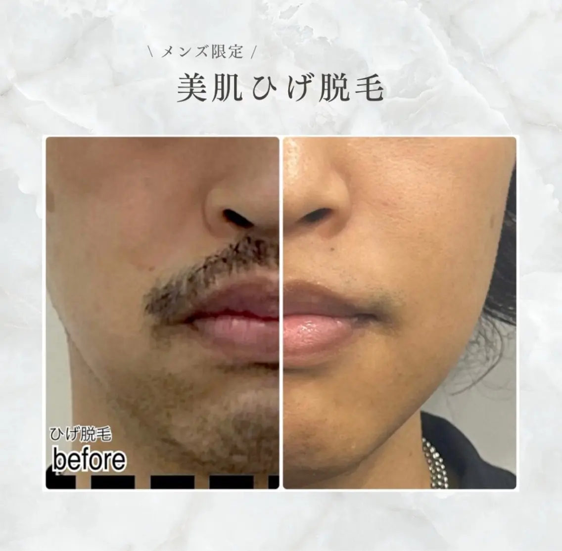エステ kamie suzuneのマツエク・マツパデザイン