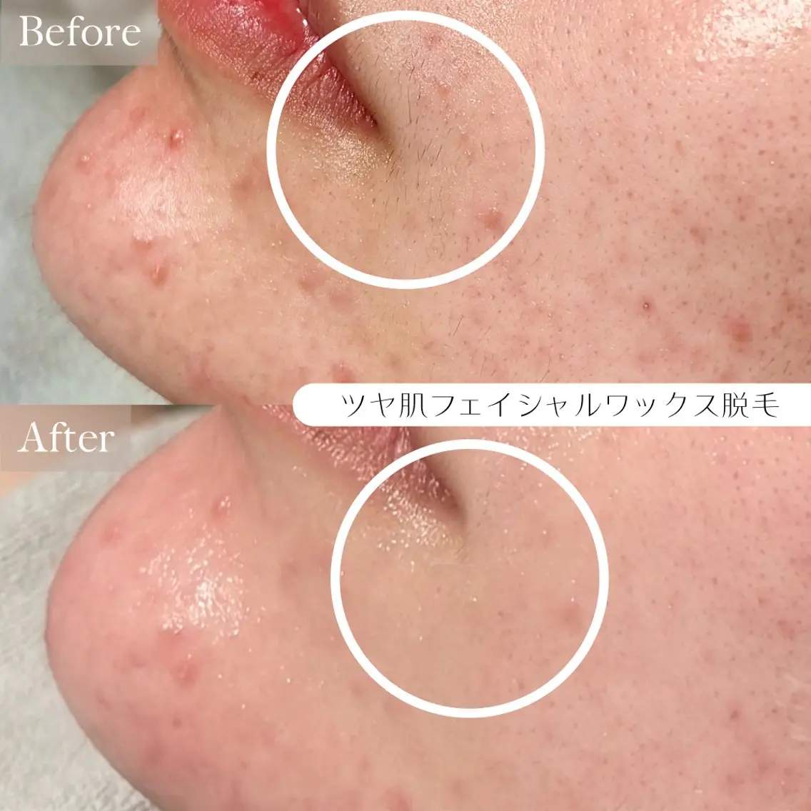 ルコル池袋【毛穴洗浄 /wax顔脱毛】えみのエステ・リラクイメージ