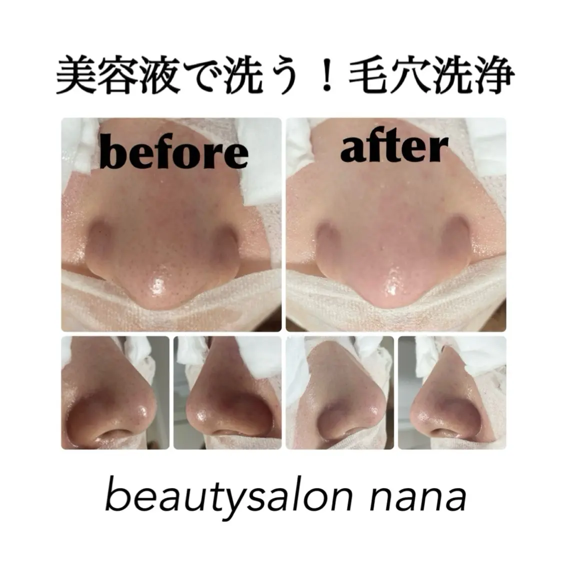 エステ beauty salon　nanaのエステ・リラクイメージ