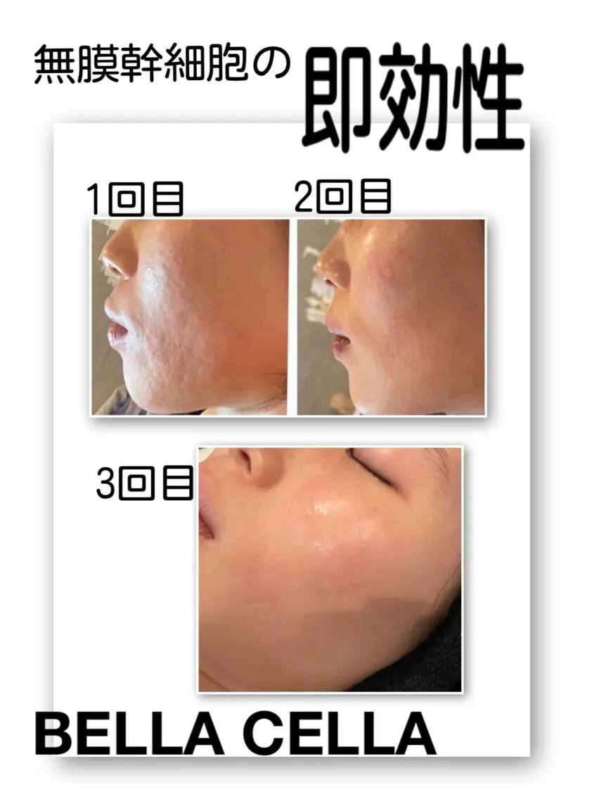 脱毛サロン mamanaのエステ・リラクイメージ