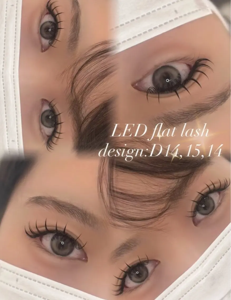 フラットラッシュ100本の写真