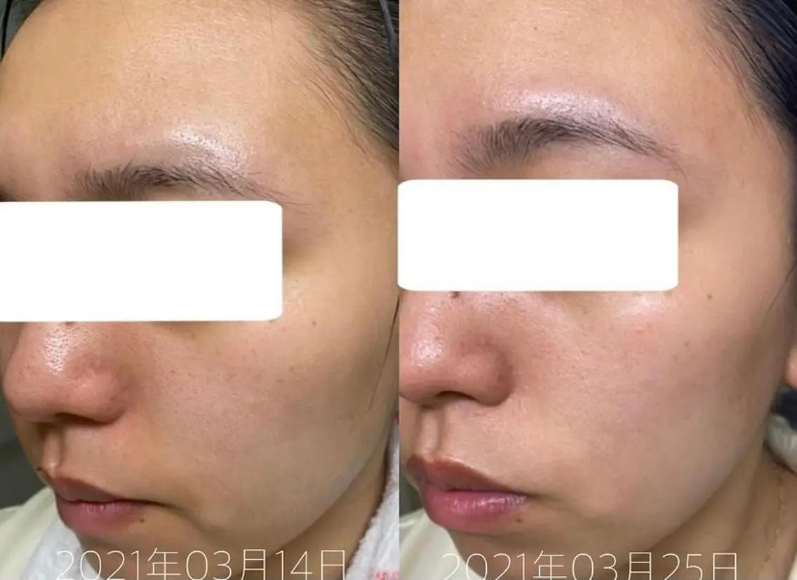 肌質改善美容サロン ému 用賀のエステ・リラクイメージ