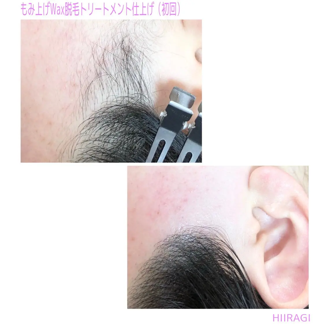 脱毛 美容室 HIIRAGIのマツエク・マツパデザイン