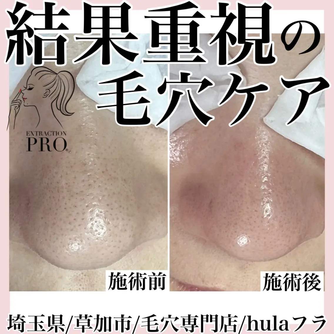 エステ 毛穴専門店hula 杉山智美のエステ・リラクイメージ