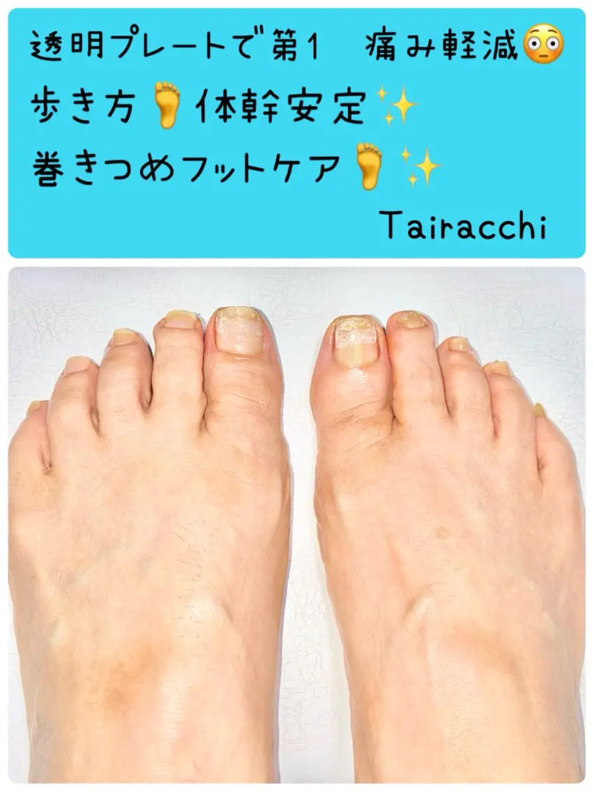 ネイル フットネイル Tairacchi ﾀｲﾗｯﾁのネイルデザイン