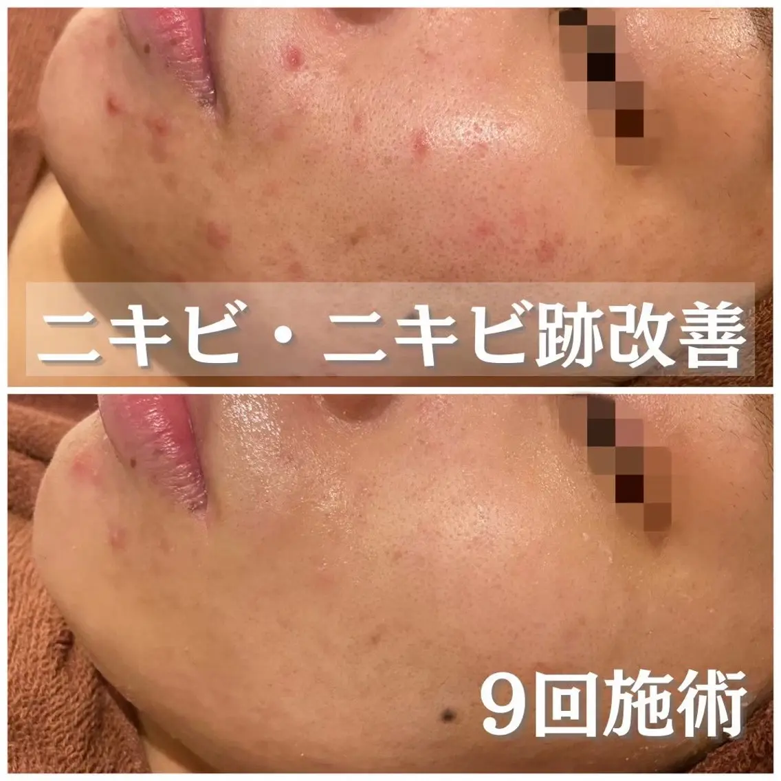 エステ リラク ニキビ・肌質改善専門 ♡人生が変わるサロンのエステ・リラクイメージ
