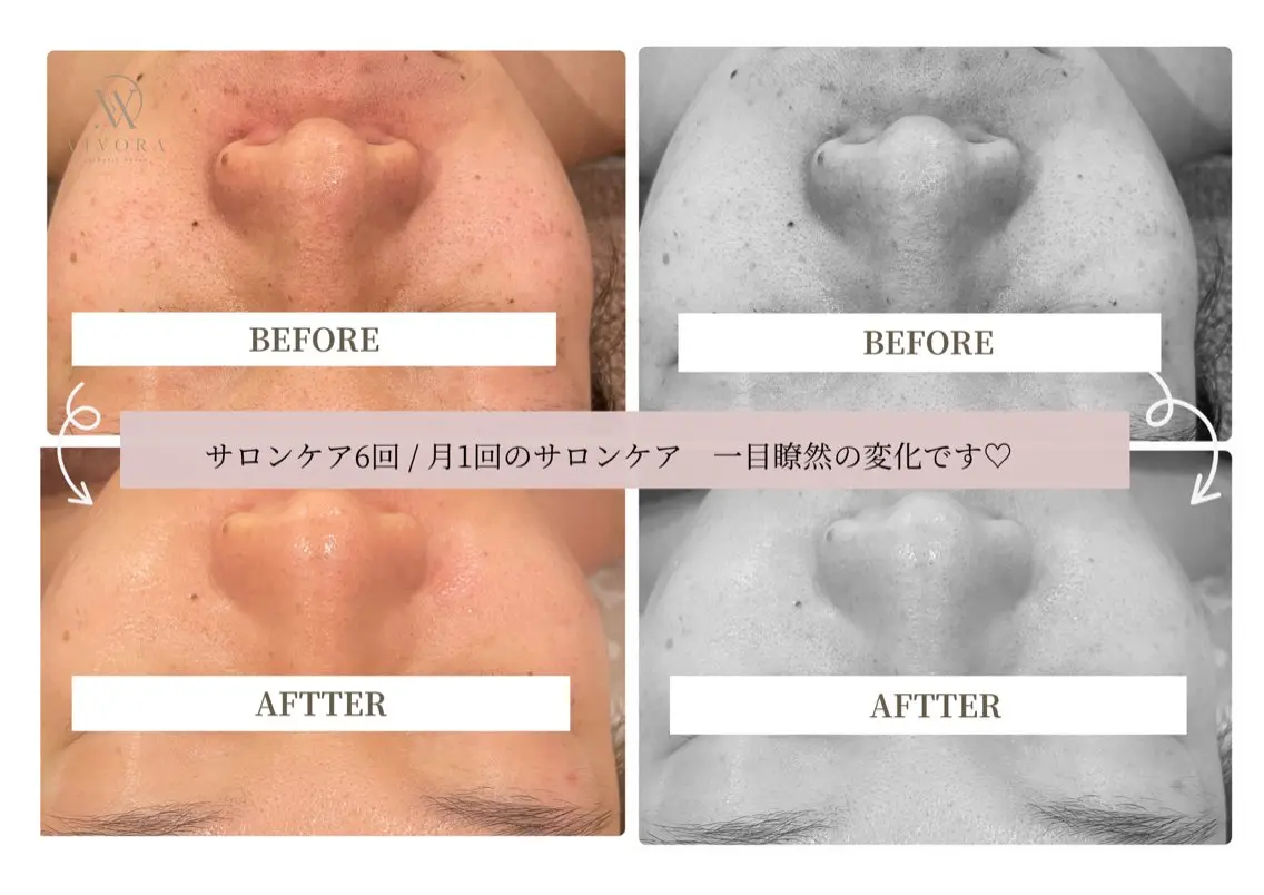 エステ VIVORA ASAMI🌿のエステ・リラクイメージ