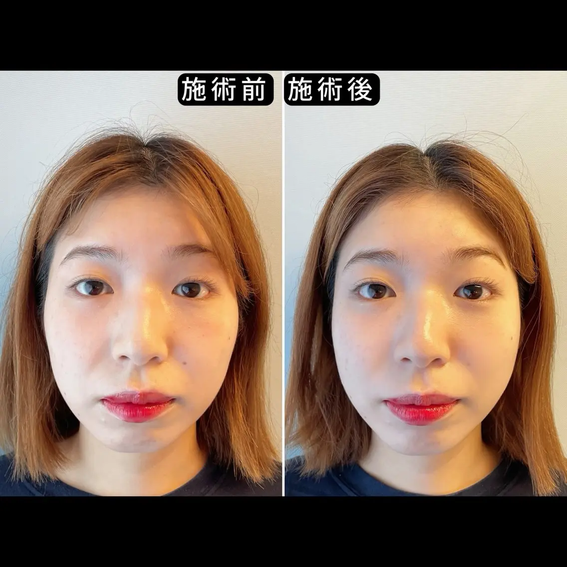 エステ リラク 渋谷 小顔美容鍼 専門サロン YZのエステ・リラクイメージ