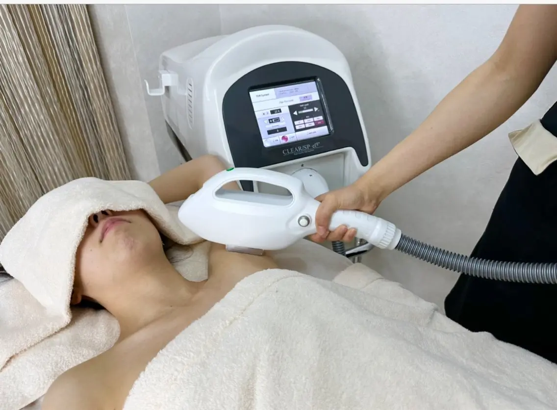 初回 女性👩【脇脱毛】の写真