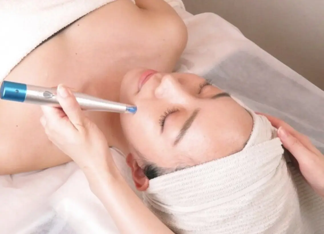 🩷18​〜​22歳限定価格🩷エステ版ダーマペン💉【リゼネレート】🪡針の美容成分を導入🫧ダウンタイム無しの写真
