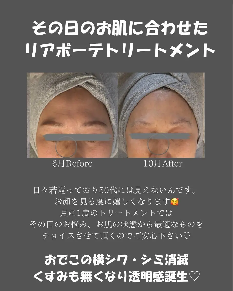 BLOSSOM 菊地のエステ・リラクイメージ