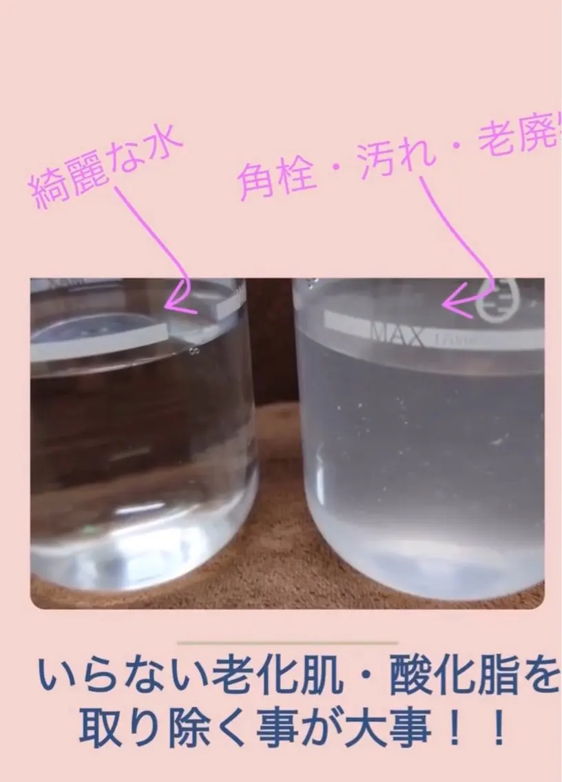 【毛穴ケア】毛穴洗浄フェイシャル+パック+毛穴洗浄ヘッドorドライヘッドケア 50分¥14,300→¥5,000の写真