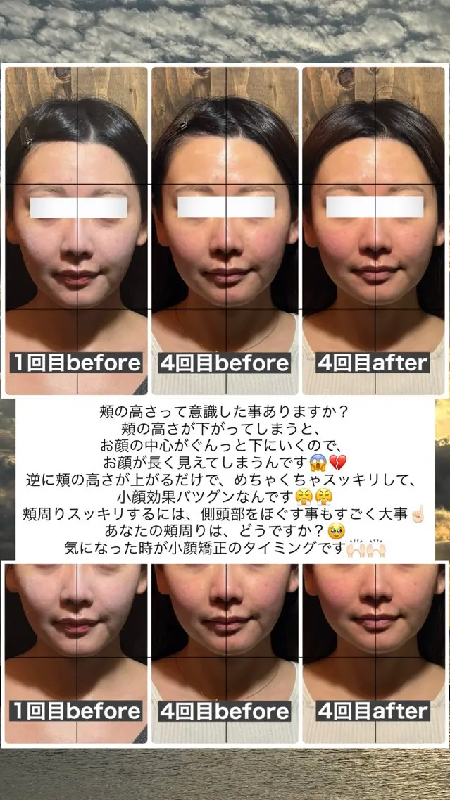 エステ リラク 💎後悔させない小顔 矯正💎イトヤマ🌱のエステ・リラクイメージ