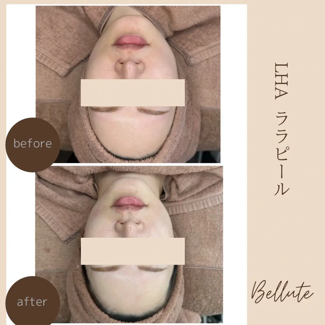 エステ ピーリング専門店 Belluteのエステ・リラクイメージ