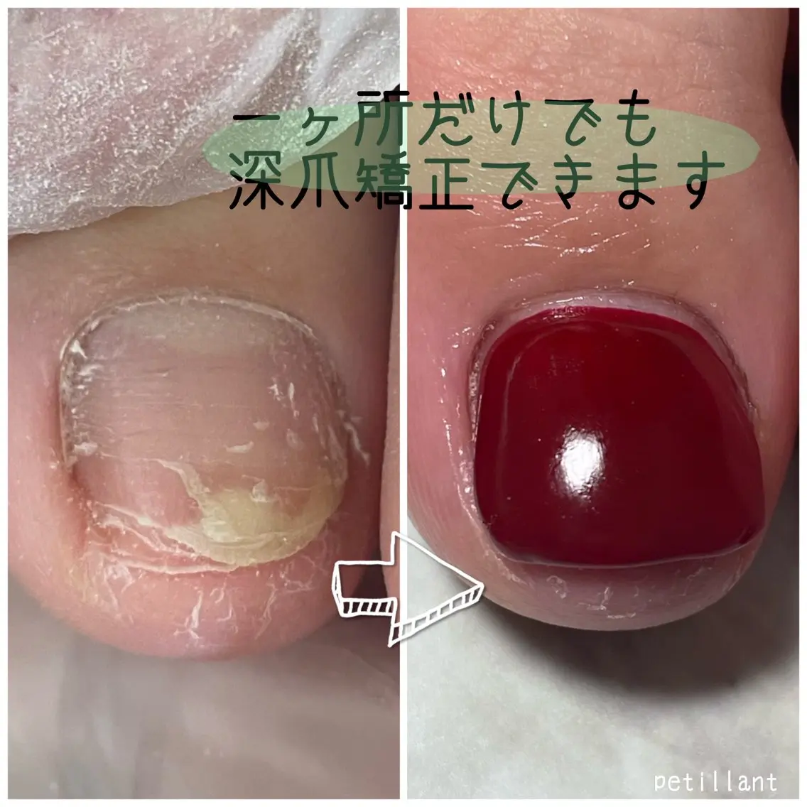 ネイル ボルドー 長さ出し フットネイル nail salon petillantのネイルデザイン