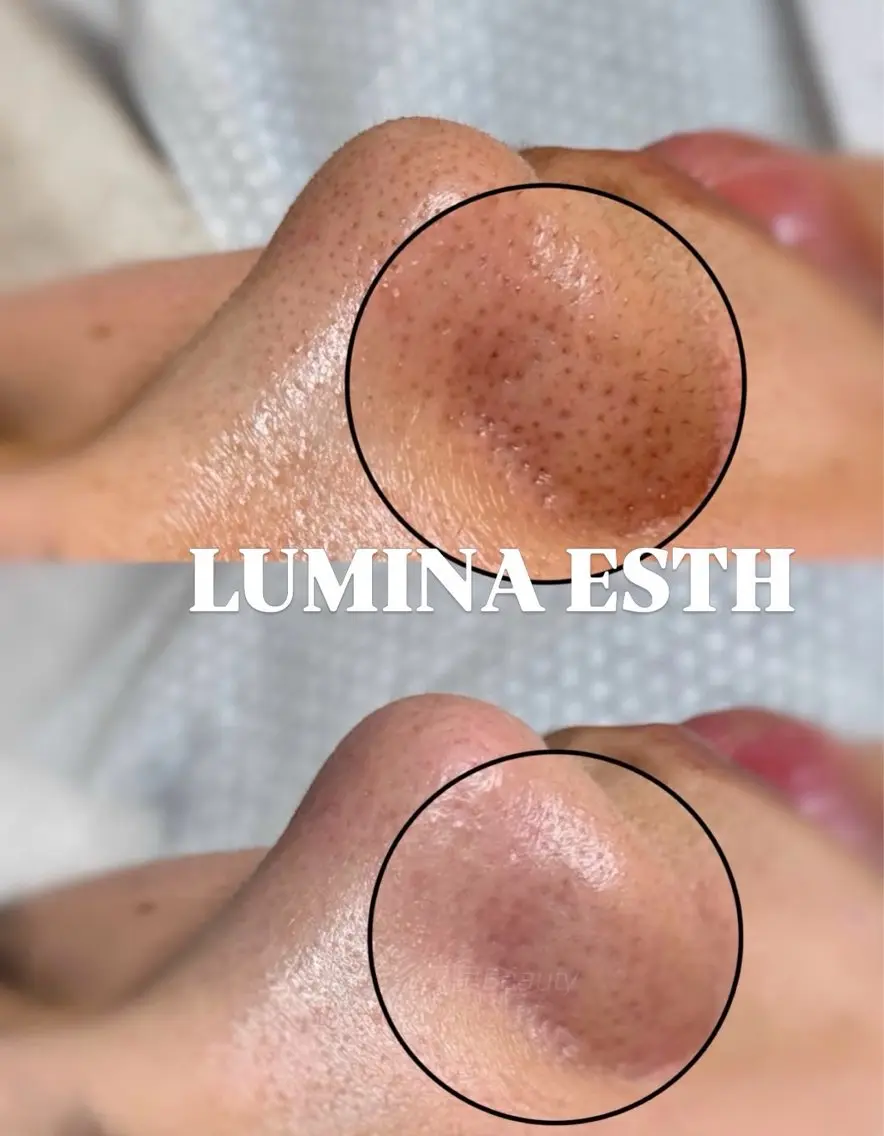 LUMINA ESTHのエステ・リラクイメージ